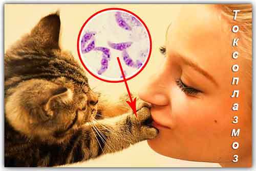 токсоплазмоз симптомы у женщин и лечение